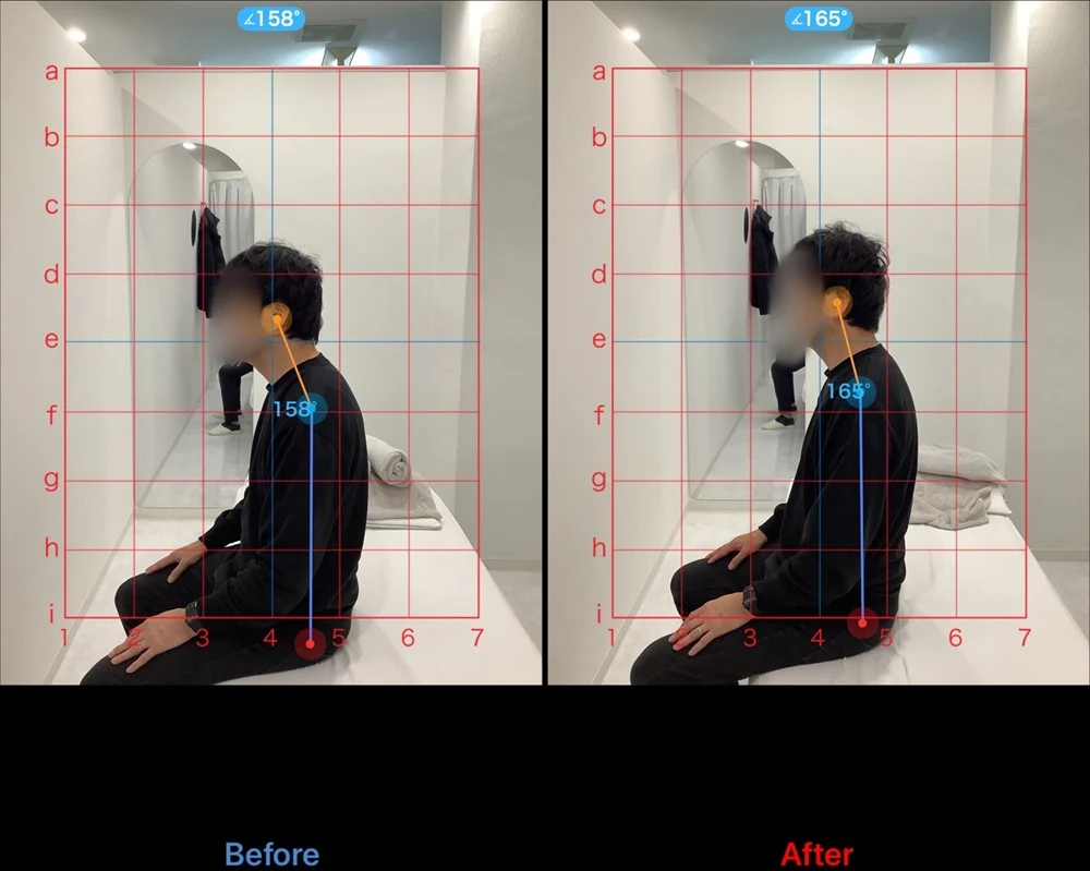 男性の座り姿勢の比較写真 左がBefore 右がAfter