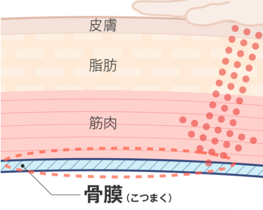 皮膚 脂肪 筋肉 骨膜の位置と 身体の表面から圧を加える骨膜整体の施術イメージ