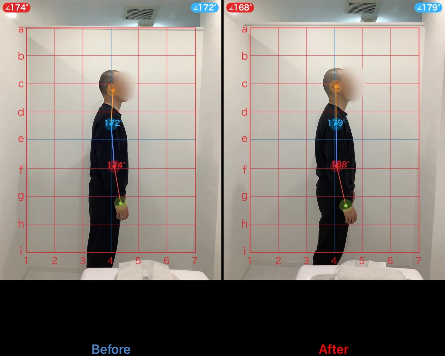 男性の立ち姿勢の比較写真 左がBefore 右がAfter